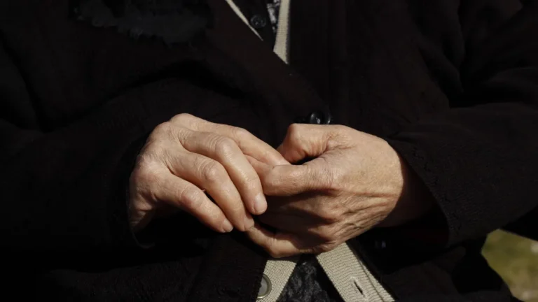 older woman hands closeup skin